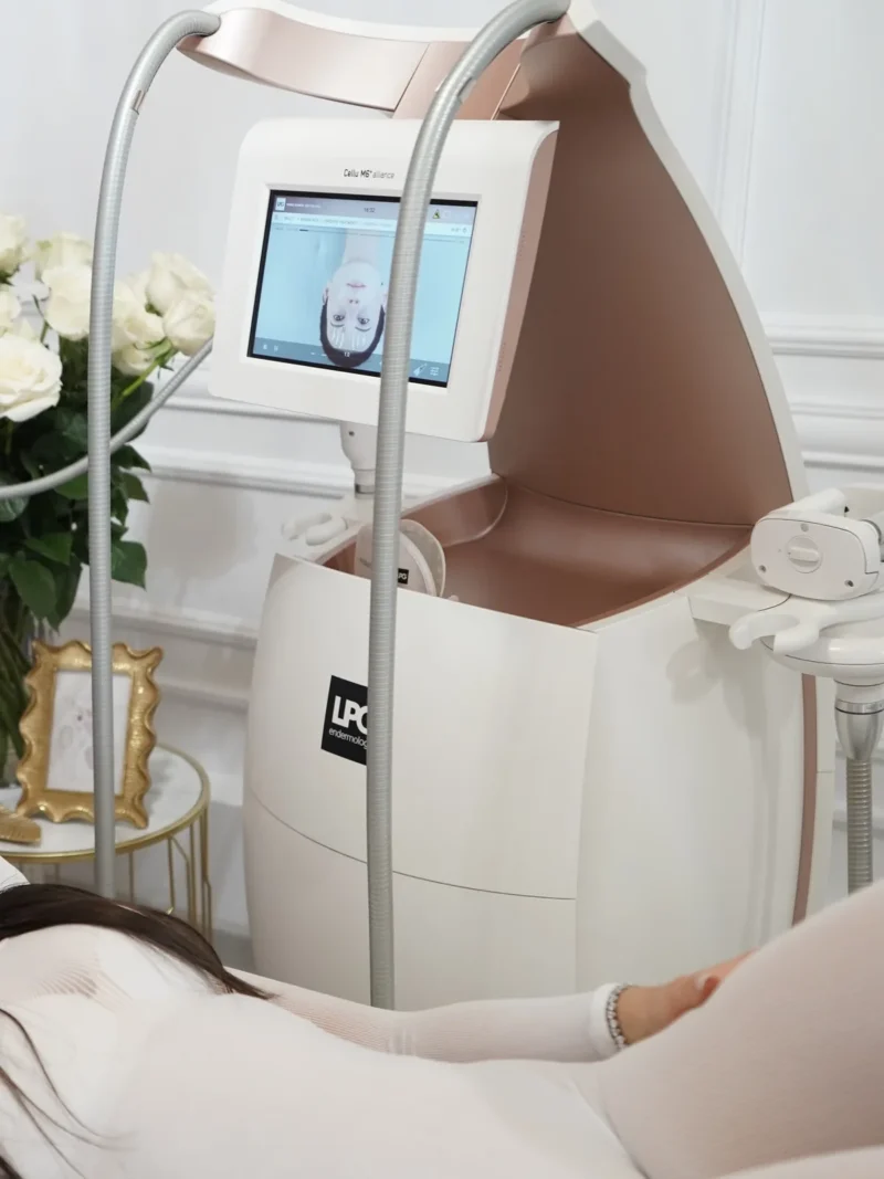 LPG Alliance facial – Clinica Ababi Radu Zalău