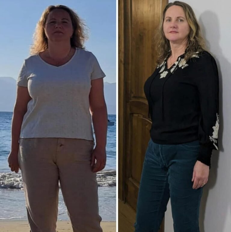Rezultate nutriție și dietetică – înainte și după – Clinica Ababi Radu