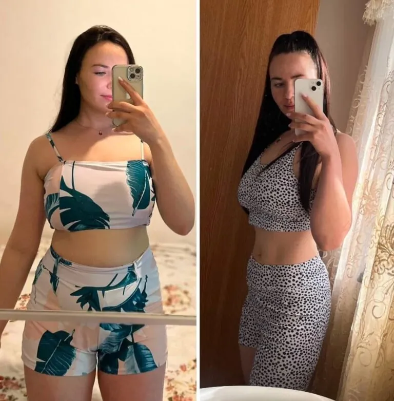 Rezultate nutriție și dietetică – înainte și după – Clinica Ababi Radu