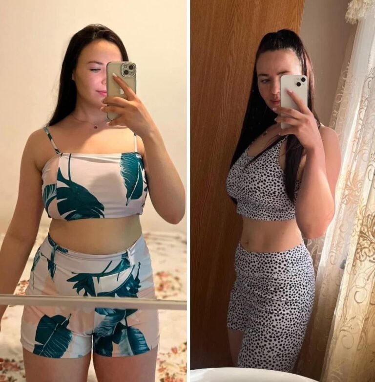 Rezultate nutriție și dietetică – înainte și după – Clinica Ababi Radu