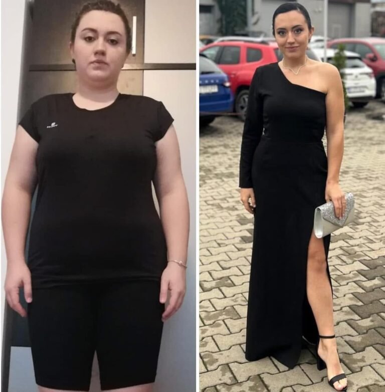Rezultate nutriție și dietetică – înainte și după – Clinica Ababi Radu