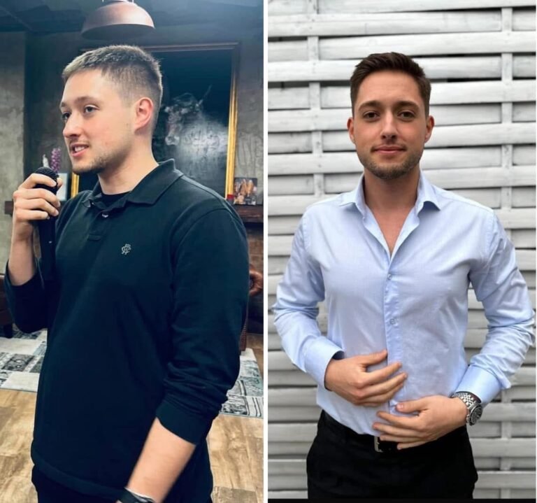 Rezultate nutriție și dietetică – înainte și după – Clinica Ababi Radu