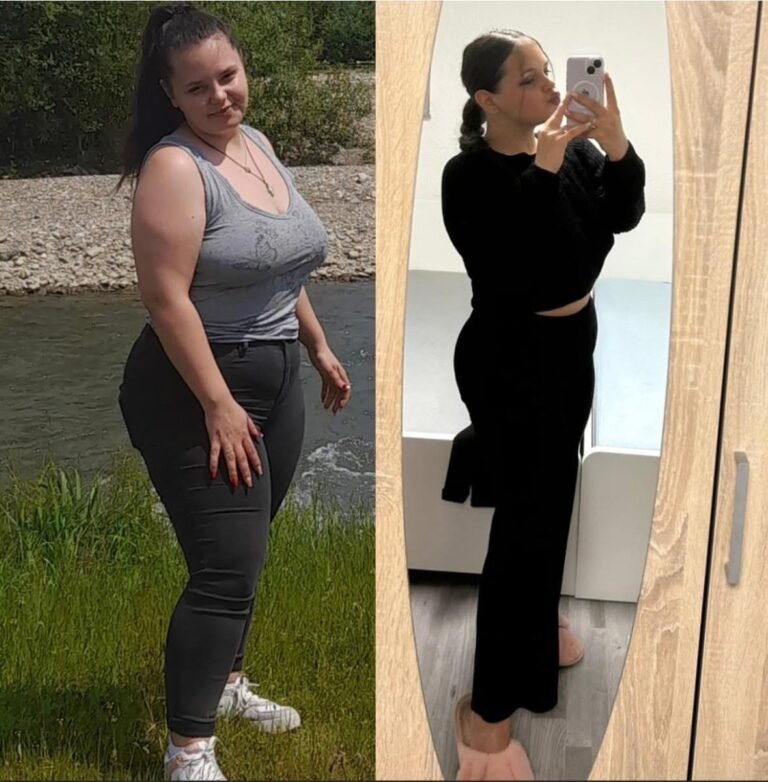 Rezultate nutriție și dietetică – înainte și după – Clinica Ababi Radu