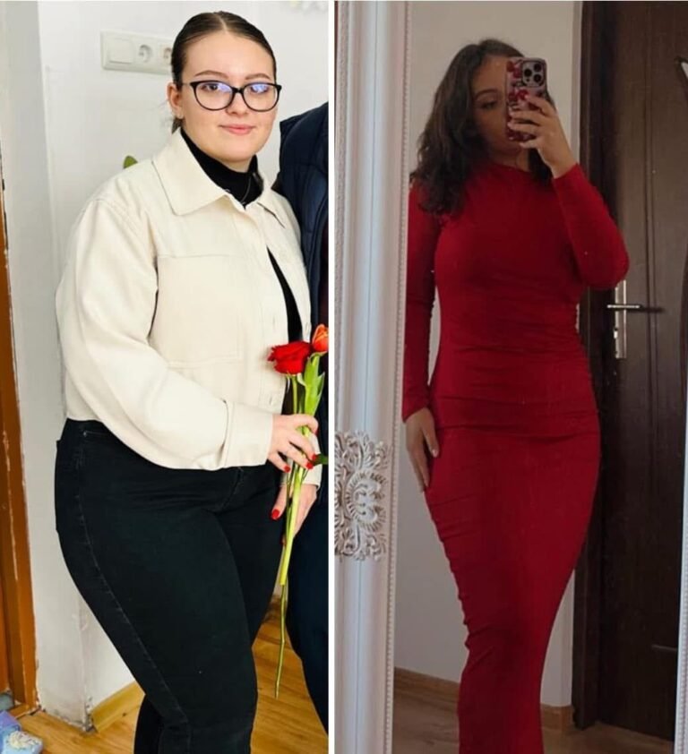 Rezultate nutriție și dietetică – înainte și după – Clinica Ababi Radu