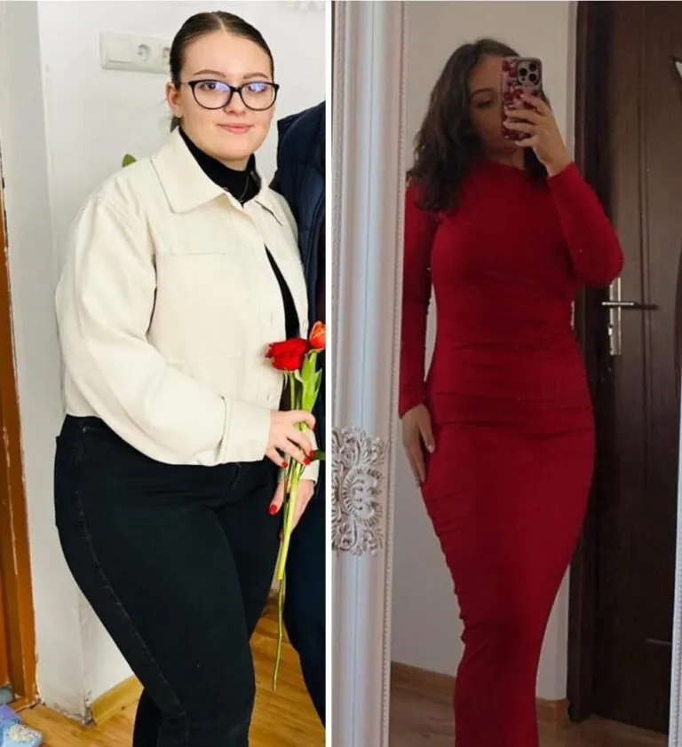 Rezultate nutriție și dietetică – înainte și după – Clinica Ababi Radu