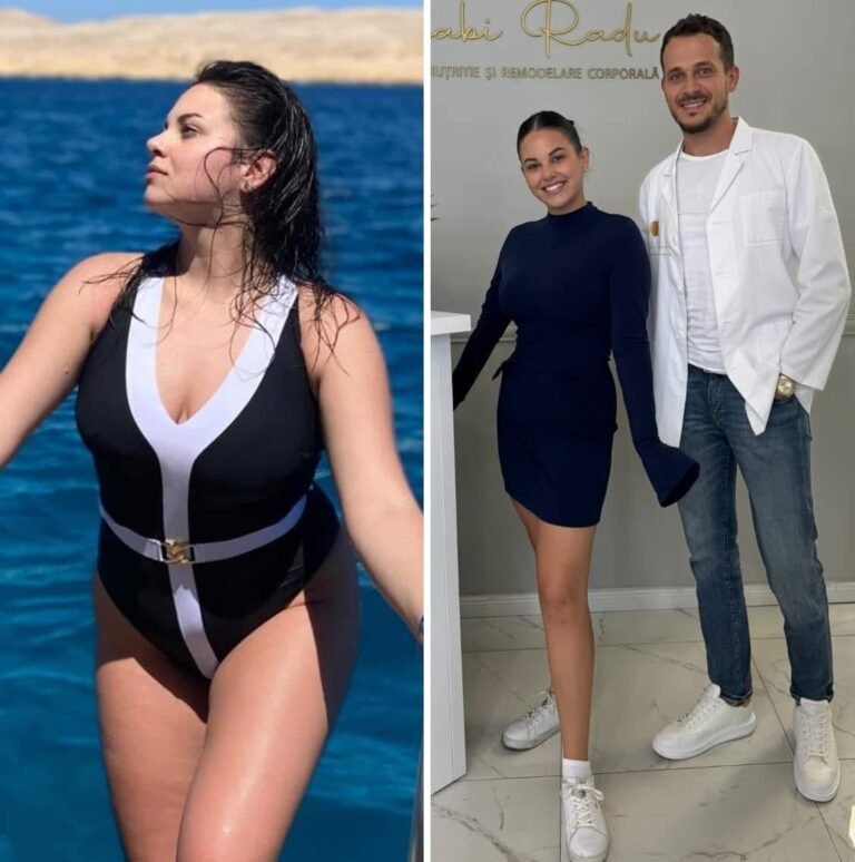 Rezultate nutriție și dietetică – înainte și după – Clinica Ababi Radu