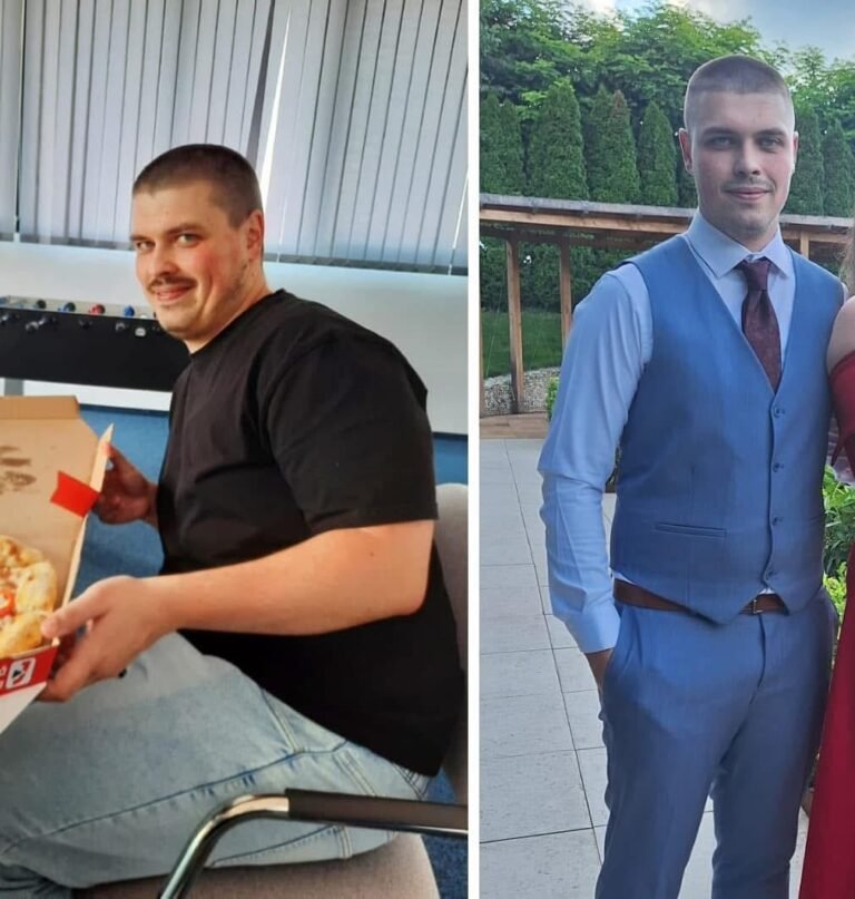 Rezultate nutriție și dietetică – înainte și după – Clinica Ababi Radu