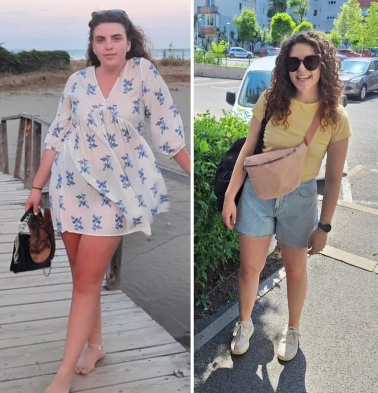 Rezultate nutriție și dietetică – înainte și după – Clinica Ababi Radu
