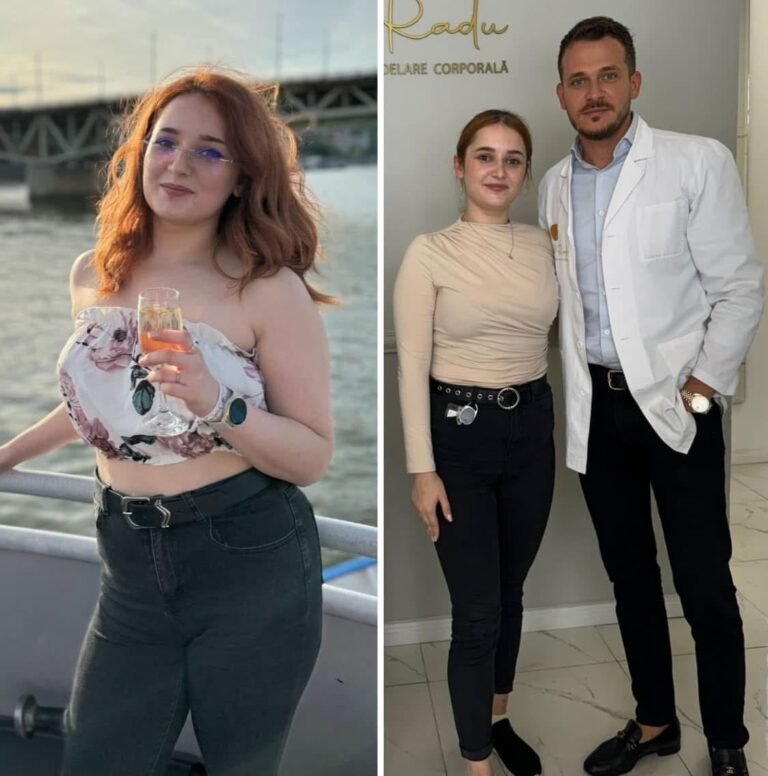 Rezultate nutriție și dietetică – înainte și după – Clinica Ababi Radu