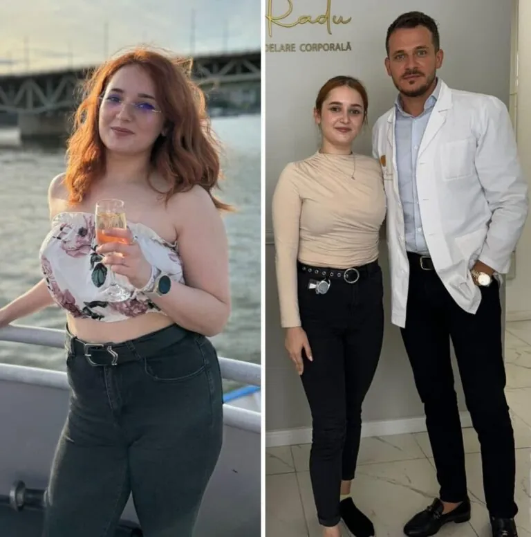 Rezultate nutriție și dietetică – înainte și după – Clinica Ababi Radu