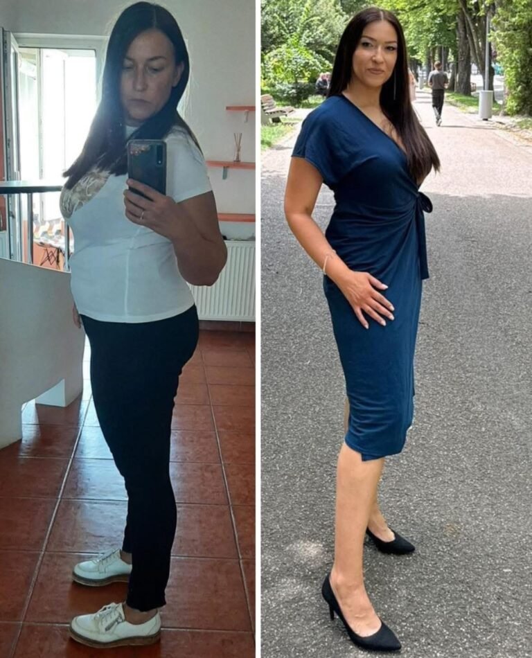Rezultate nutriție și dietetică – înainte și după – Clinica Ababi Radu