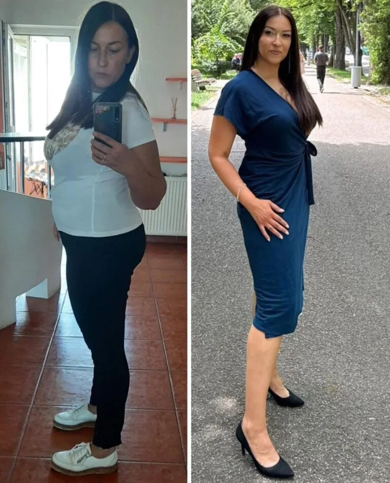 Rezultate nutriție și dietetică – înainte și după – Clinica Ababi Radu