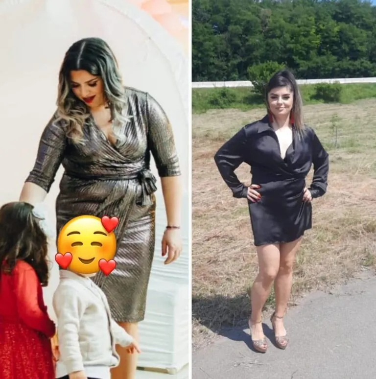 Rezultate nutriție și dietetică – înainte și după – Clinica Ababi Radu