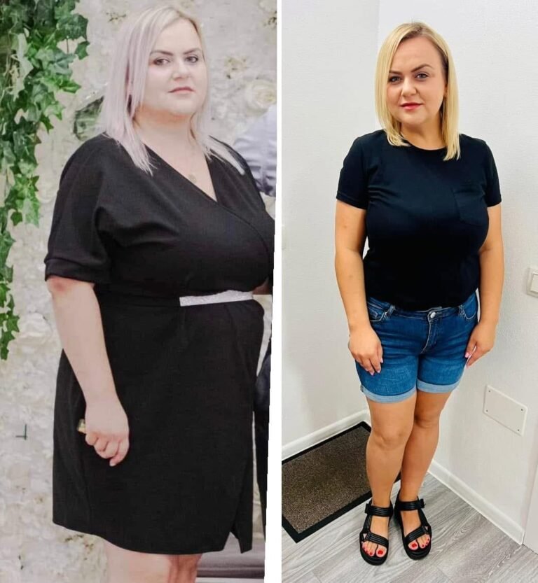 Rezultate nutriție și dietetică – înainte și după – Clinica Ababi Radu
