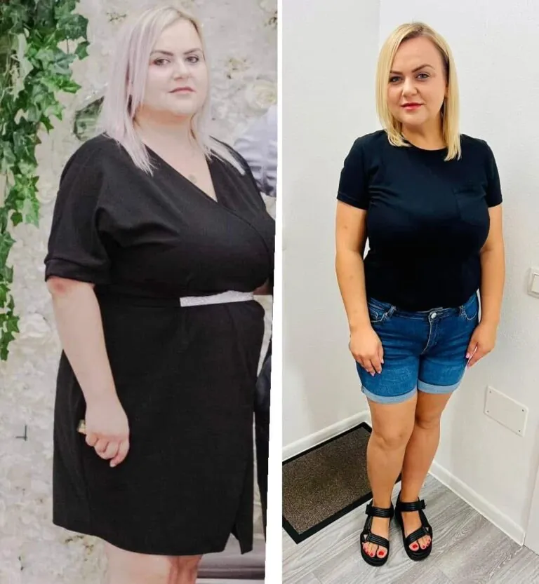 Rezultate nutriție și dietetică – înainte și după – Clinica Ababi Radu