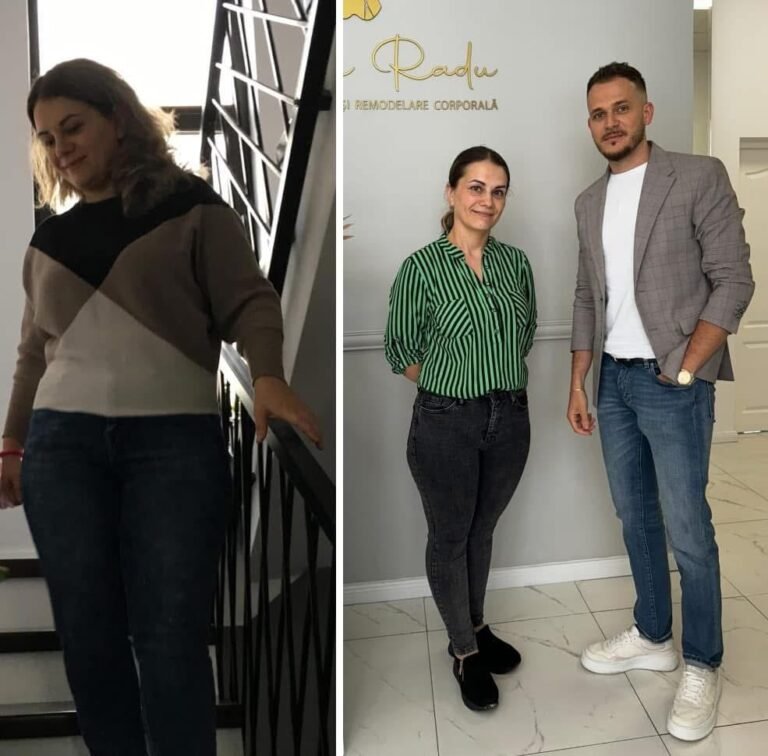 Rezultate nutriție și dietetică – înainte și după – Clinica Ababi Radu