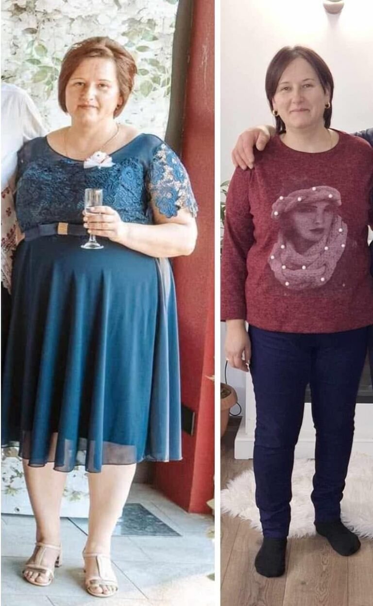 Rezultate nutriție și dietetică – înainte și după – Clinica Ababi Radu