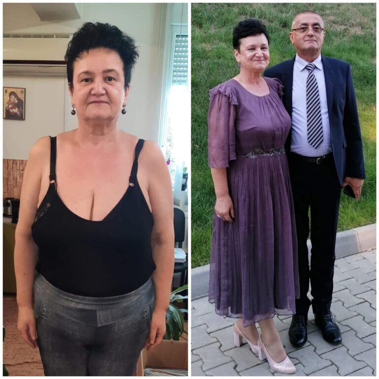 Rezultate nutriție și dietetică – înainte și după – Clinica Ababi Radu