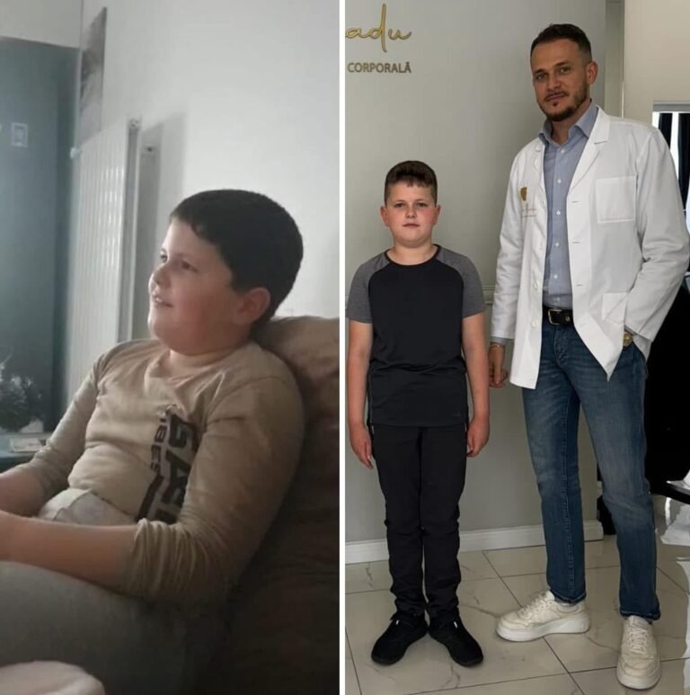Rezultate nutriție și dietetică – înainte și după – Clinica Ababi Radu