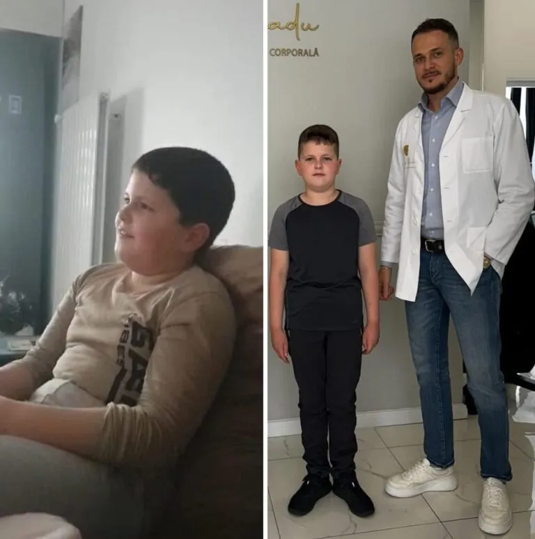 Rezultate nutriție și dietetică – înainte și după – Clinica Ababi Radu
