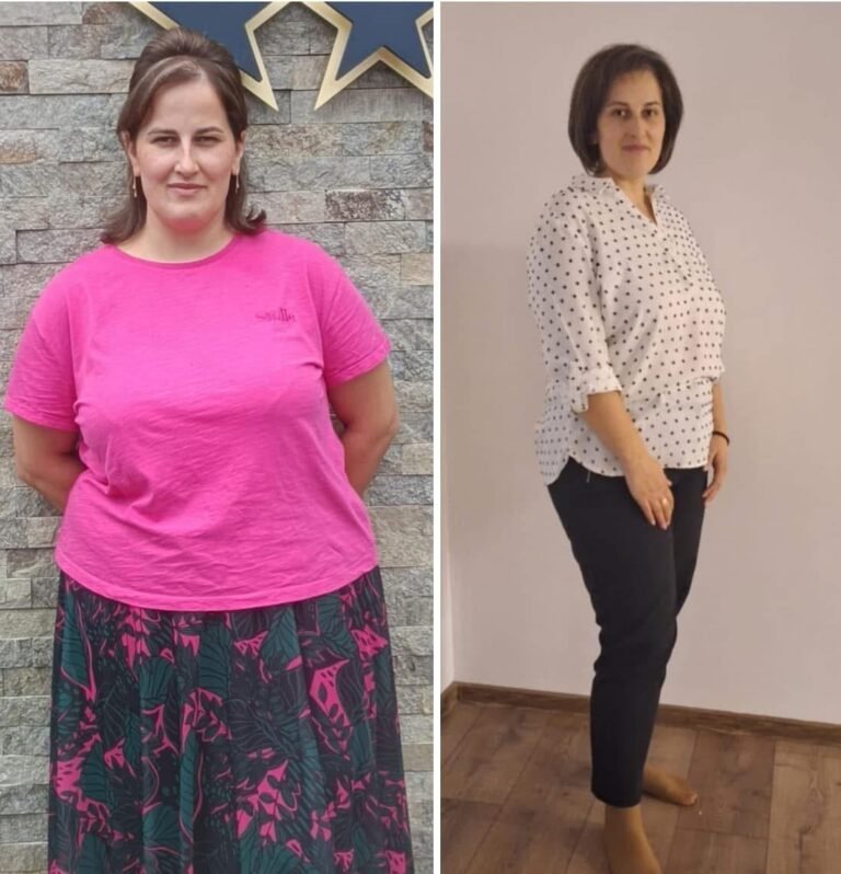 Rezultate nutriție și dietetică – înainte și după – Clinica Ababi Radu