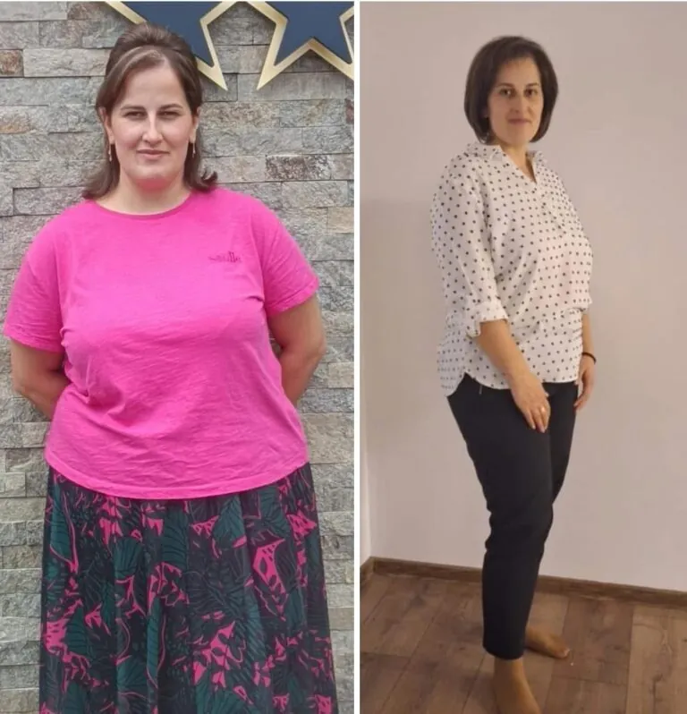Rezultate nutriție și dietetică – înainte și după – Clinica Ababi Radu